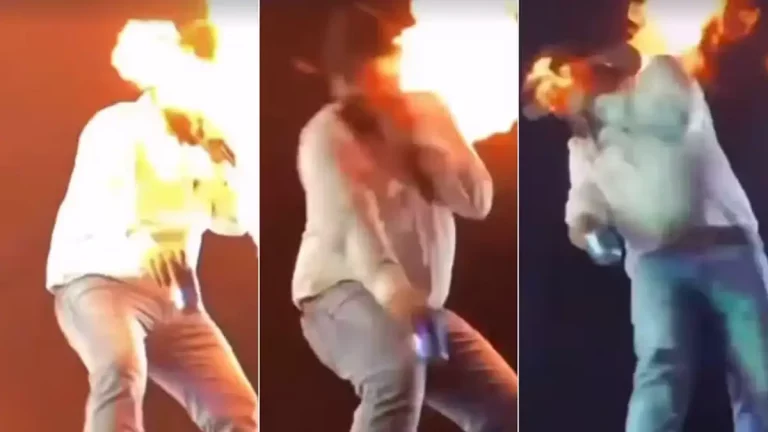 Cantor Leo sofre queimaduras em show